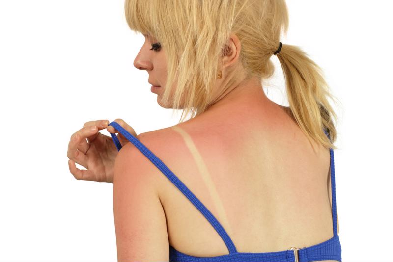 Your skin is a hardy organ, but even it can't stand up to hours in the sun.
