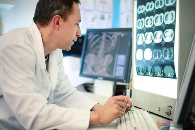 Doctor looking over brain scans displayed on a computer screen.