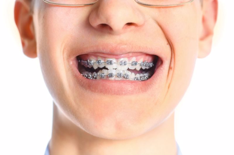 Smiling child with braces